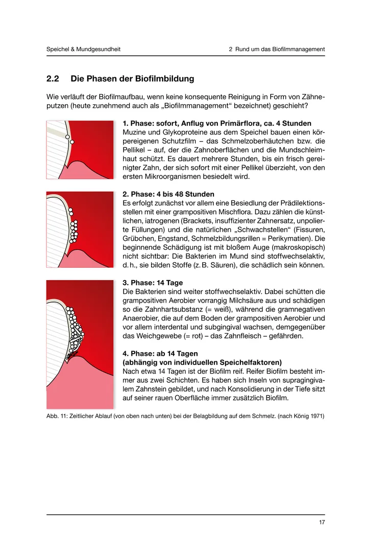 Seite 17 - SalivaDent - Lehr- und Lernprogramm zum Thema Speichel und Mundgesundheit - Skript