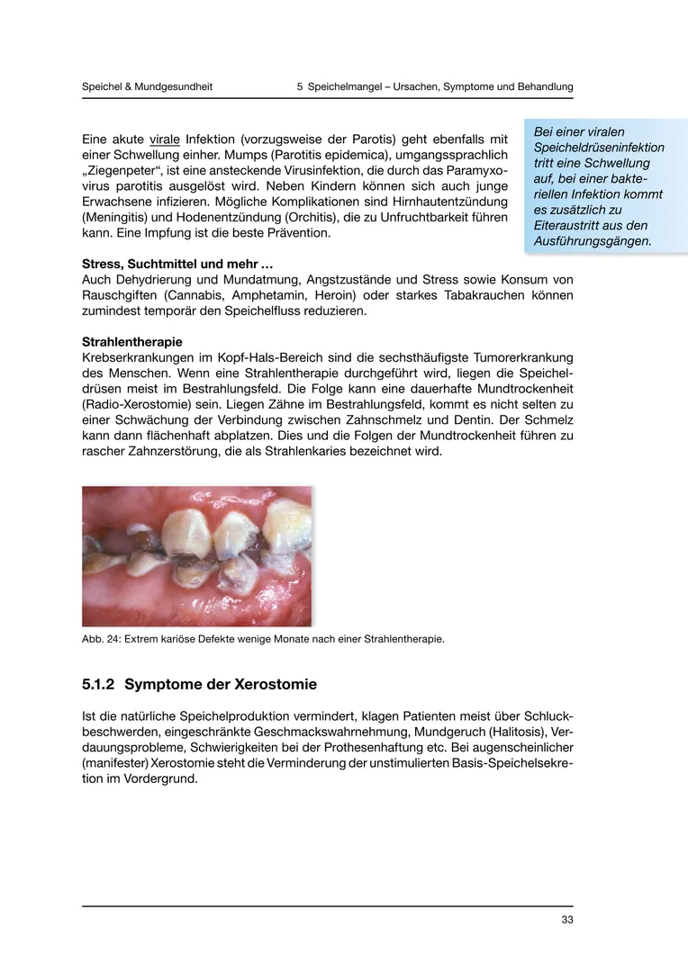 Seite 33 - SalivaDent - Lehr- und Lernprogramm zum Thema Speichel und Mundgesundheit - Skript