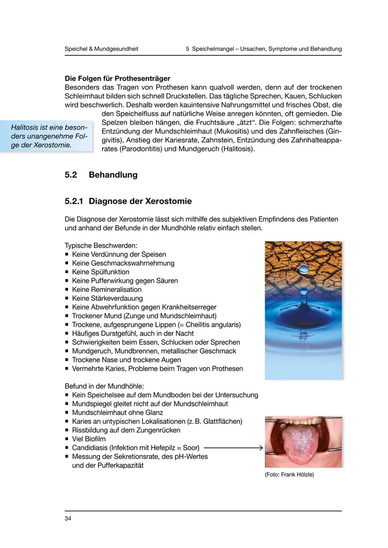 Seite 34 - SalivaDent - Lehr- und Lernprogramm zum Thema Speichel und Mundgesundheit - Skript