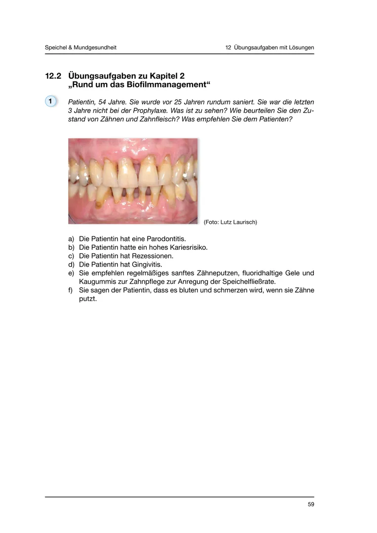Seite 59 - SalivaDent - Lehr- und Lernprogramm zum Thema Speichel und Mundgesundheit - Skript
