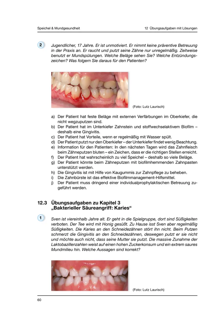 Seite 60 - SalivaDent - Lehr- und Lernprogramm zum Thema Speichel und Mundgesundheit - Skript