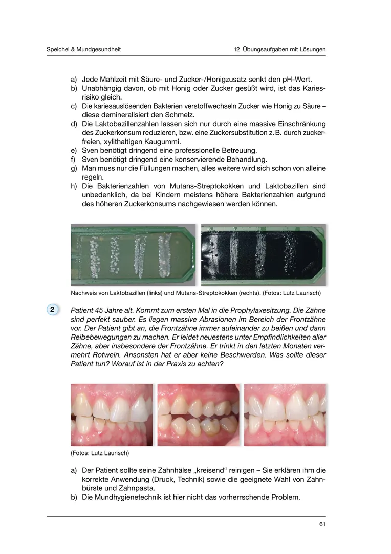 Seite 61 - SalivaDent - Lehr- und Lernprogramm zum Thema Speichel und Mundgesundheit - Skript