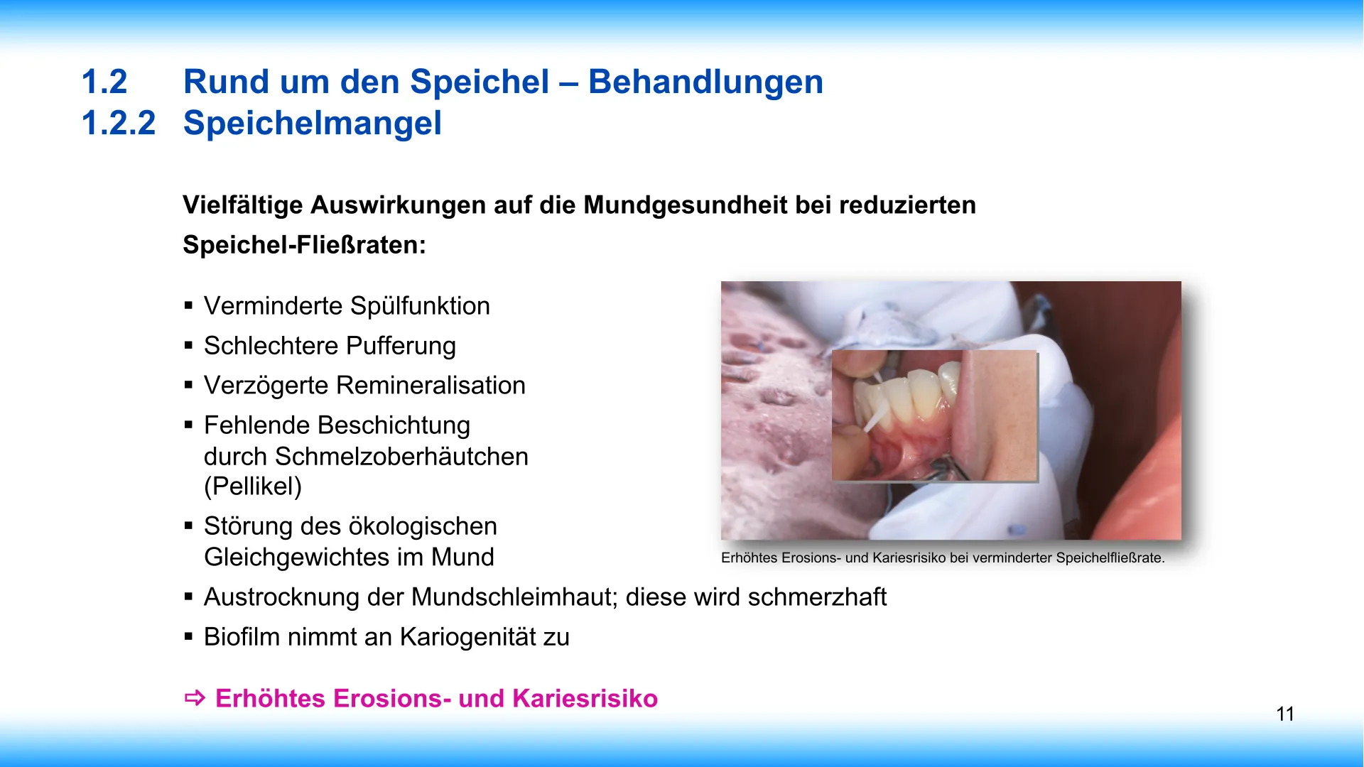 Seite 11 - SalivaDent - Lehr- und Lernprogramm zum Thema Speichel und Mundgesundheit - PowerPoint