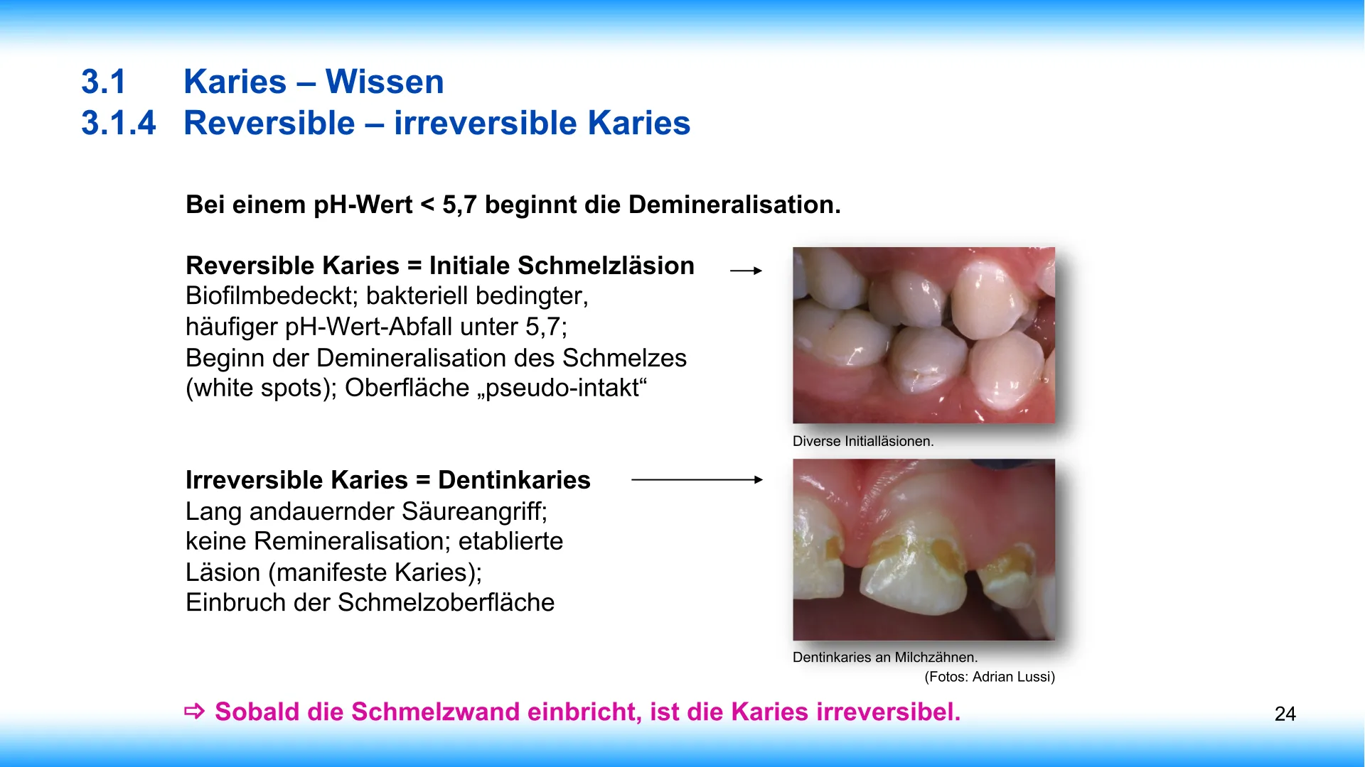 Seite 24 - SalivaDent - Lehr- und Lernprogramm zum Thema Speichel und Mundgesundheit - PowerPoint