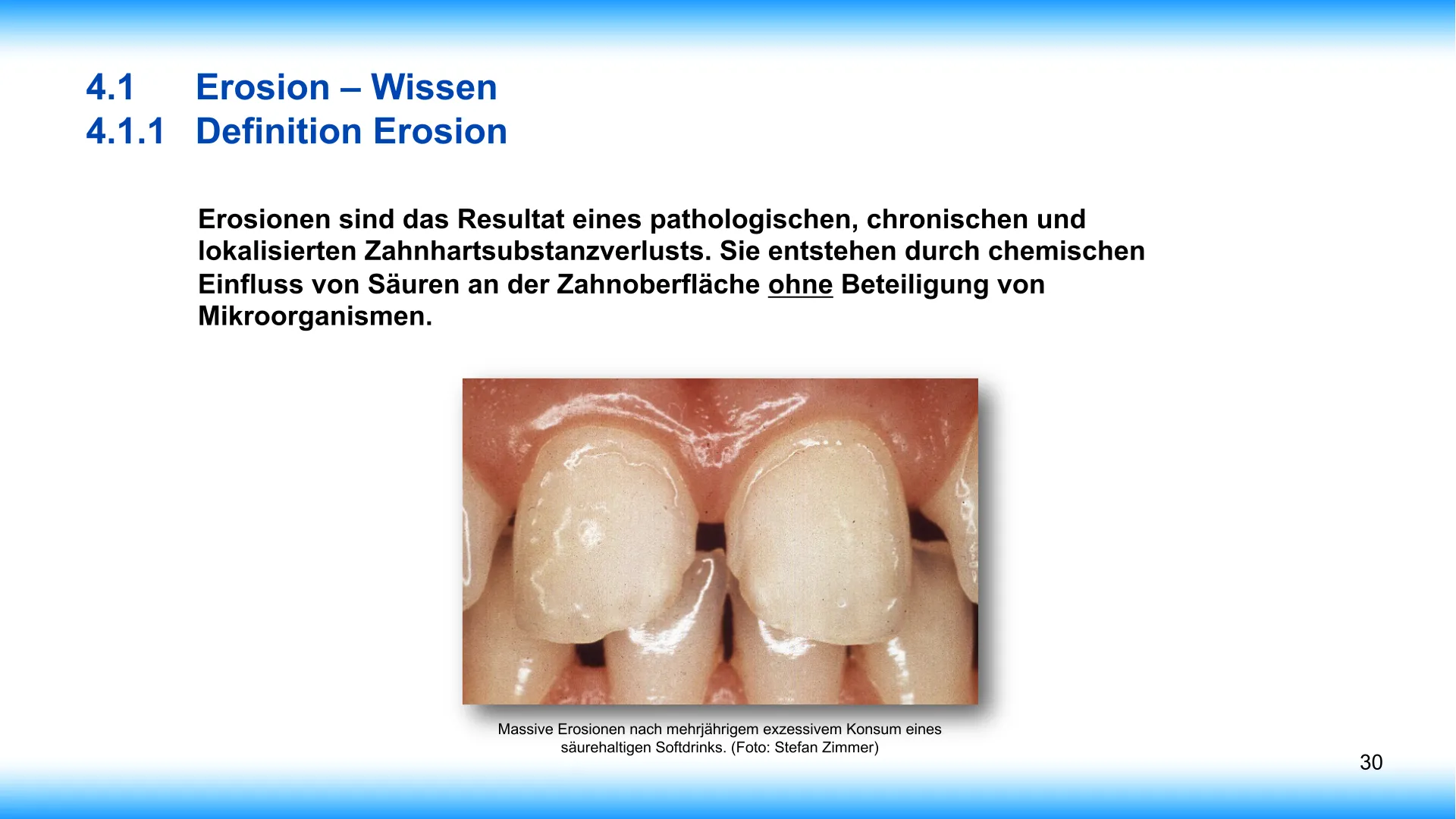 Seite 30 - SalivaDent - Lehr- und Lernprogramm zum Thema Speichel und Mundgesundheit - PowerPoint