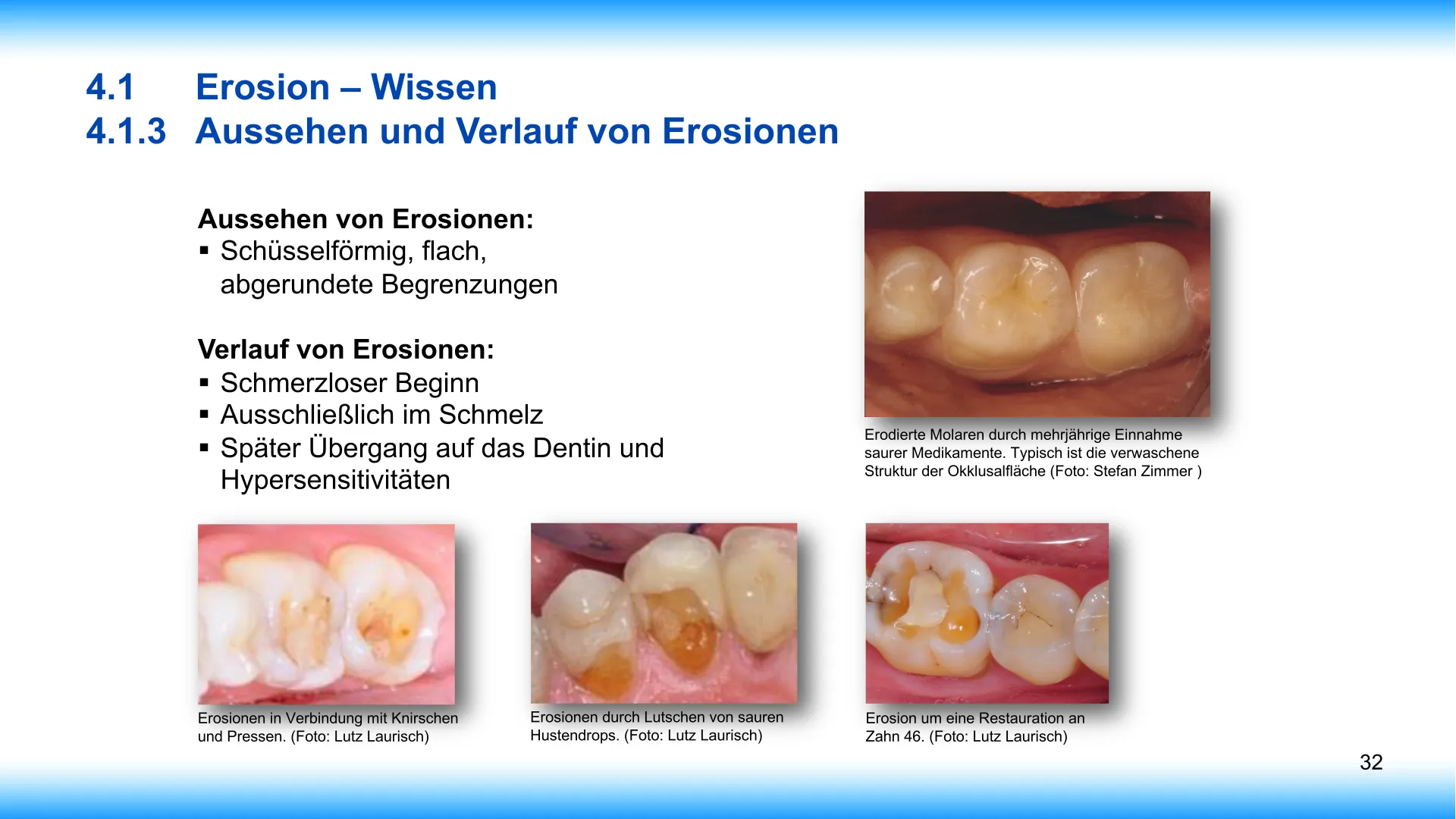 Seite 32 - SalivaDent - Lehr- und Lernprogramm zum Thema Speichel und Mundgesundheit - PowerPoint