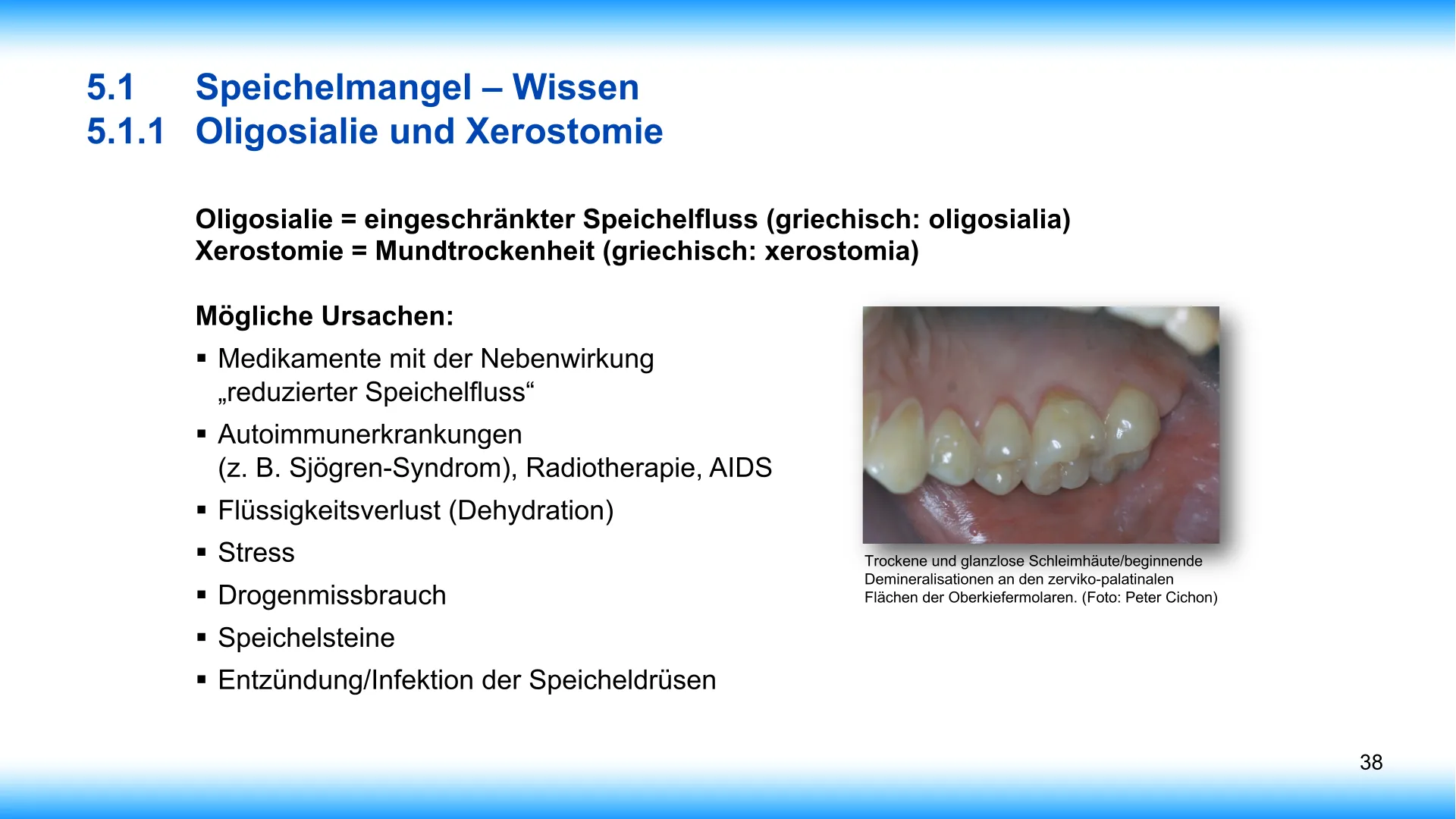 Seite 38 - SalivaDent - Lehr- und Lernprogramm zum Thema Speichel und Mundgesundheit - PowerPoint