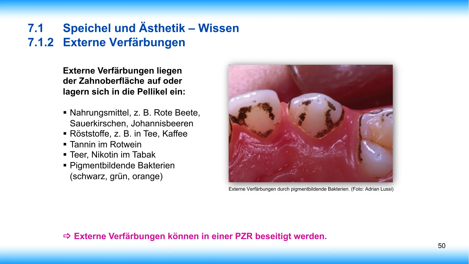 Seite 50 - SalivaDent - Lehr- und Lernprogramm zum Thema Speichel und Mundgesundheit - PowerPoint