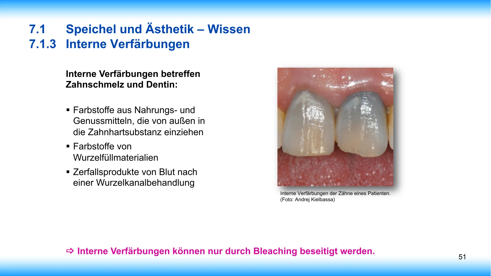 Seite 51 - SalivaDent - Lehr- und Lernprogramm zum Thema Speichel und Mundgesundheit - PowerPoint