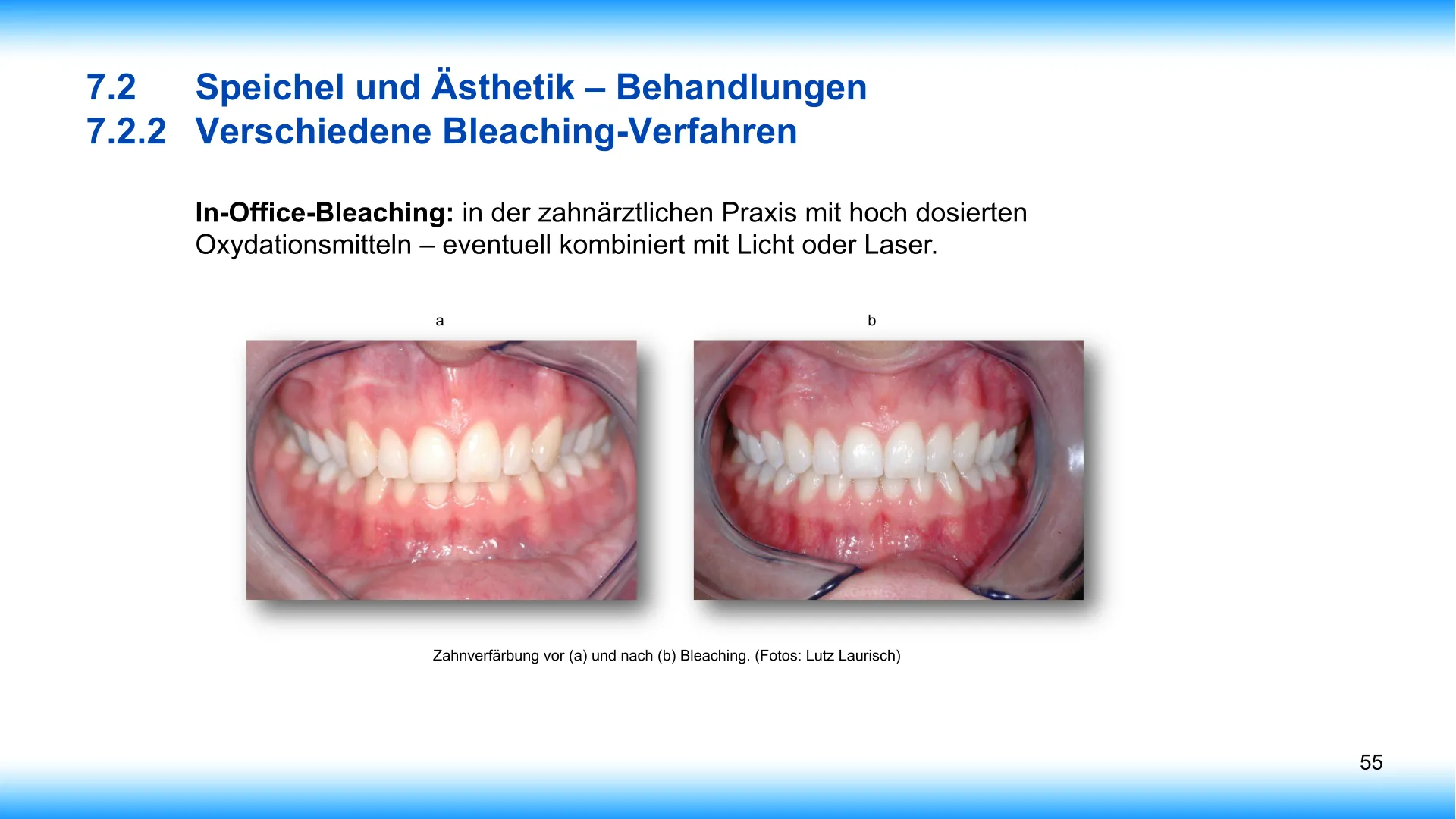 Seite 55 - SalivaDent - Lehr- und Lernprogramm zum Thema Speichel und Mundgesundheit - PowerPoint