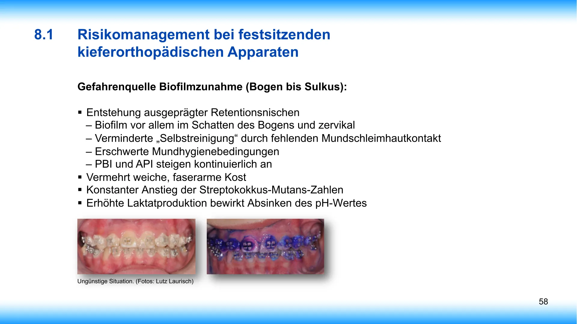 Seite 58 - SalivaDent - Lehr- und Lernprogramm zum Thema Speichel und Mundgesundheit - PowerPoint