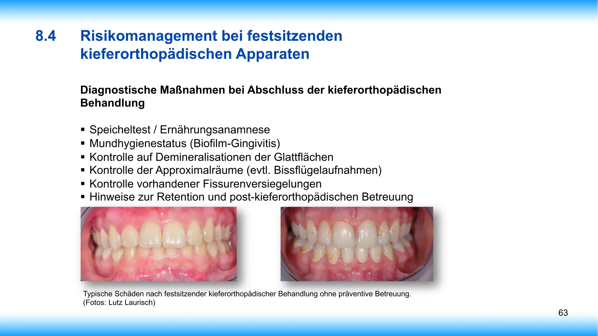 Seite 63 - SalivaDent - Lehr- und Lernprogramm zum Thema Speichel und Mundgesundheit - PowerPoint